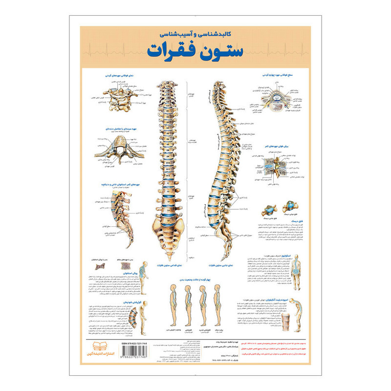 پوستر آموزشی انتشارات اندیشه کهن مدل کالبدشناسی و آسیب شناسی ستون فقرات